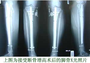 <em>女生长到几岁</em>就停止长高了?一米五八五九是不