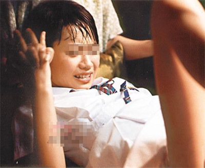 外阴恶性肿瘤_360百科